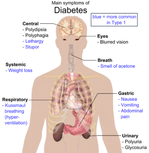 300px-Main_symptoms_of_diabetes