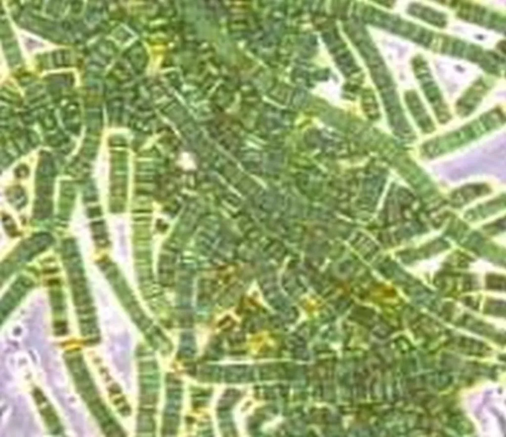 PA: Israeli Antibiotics Erasing Direct Palestinian Descent From Local Bacteria