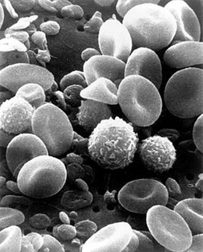 European White Blood Cells More Likely To Let Pathogens In Unmolested